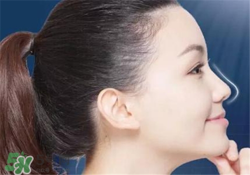 隆鼻會拉近眼距嗎？隆鼻會改變眼睛嗎？