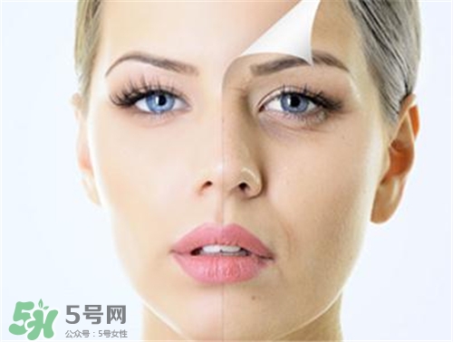 玻尿酸除皺有效果嗎？玻尿酸除皺效果怎么樣？
