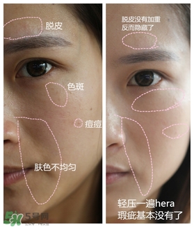 赫拉氣墊用了悶痘嗎？赫拉氣墊悶痘怎么辦？