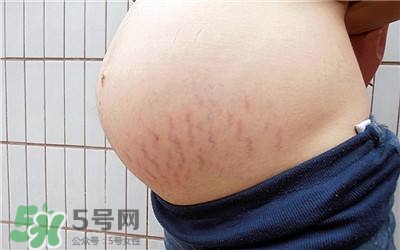 妊娠紋幾個(gè)月開始出現(xiàn)？妊娠紋能消除掉嗎？