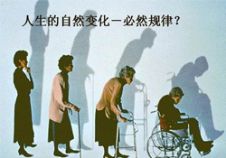哪些人容易得骨質疏松癥？骨質疏松的高發人群有哪些？