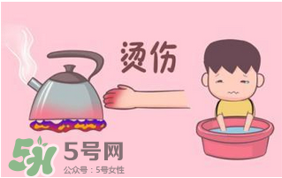 燙傷可以用牙膏嗎？燙傷用牙膏管用嗎？
