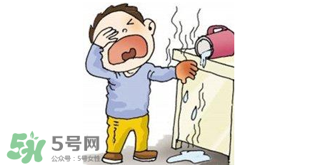 燙傷可以用牙膏嗎？燙傷用牙膏管用嗎？