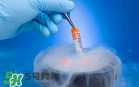 凍卵是什么？凍卵子需要多少錢？
