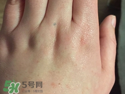 薇諾娜適合什么皮膚？薇諾娜適合敏感肌嗎？