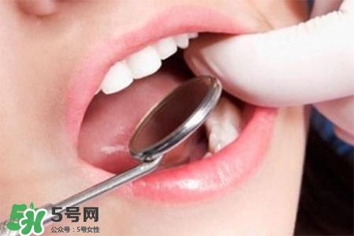 口腔異味是怎么回事？口腔異味怎么清除？