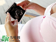 保胎期間可以洗澡嗎？臥床保胎可以洗澡嗎？