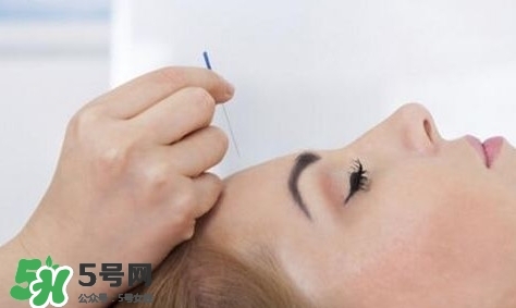 叢集性頭痛會死人嗎？叢集性頭痛的特點