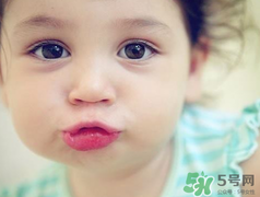 孕期可以激光祛斑嗎？懷孕了能做激光祛斑嗎？