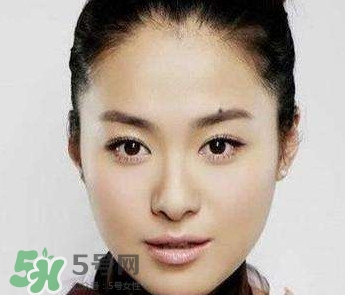 如何預防臉上長痣？怎樣預防臉上長痣