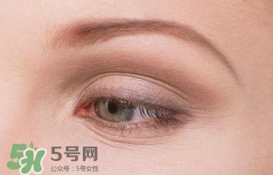怎樣祛除眼底細紋？如何去除眼底細紋