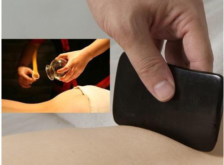 刮痧之后可以拔罐嗎？刮痧之后可不可以拔罐