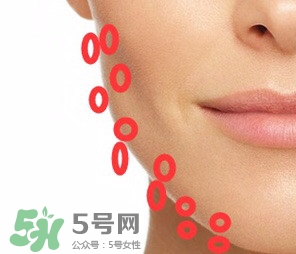 nuface美容儀有效嗎？nuface美容儀副作用？