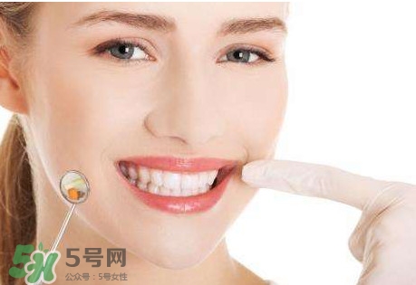 牙結石是什么？牙結石圖片