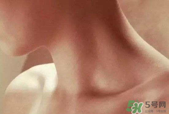 頸椎老化是什么病？頸椎老化的癥狀