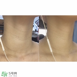 悅薇適合什么年齡？資生堂悅薇適合年齡段