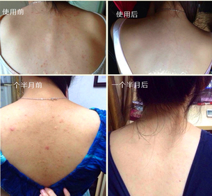 sana美背噴霧兩種款式區別 sana美背噴霧新舊包裝對比