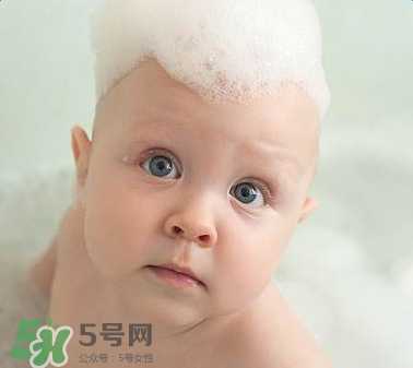 寶寶頭皮上的污垢可以摳掉嗎？寶寶頭上的頭垢該怎么處理？