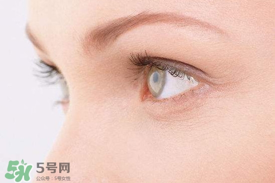 眼睛布滿血絲怎么回事？眼睛布滿血絲怎么辦