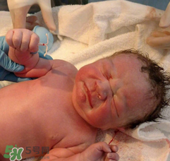 新生兒手握避孕環(huán)出生是怎么回事？出生后健康嗎？