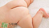 尿布疹怎么辦？寶寶尿布疹擦什么藥好？