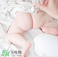 尿布疹和濕疹的區別 尿布疹和濕疹如何區分？