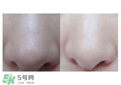 碧柔鼻貼白色和黑色哪個好？碧柔鼻貼黑白區別