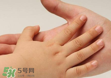 寶寶指甲凹凸不平是什么原因？寶寶指甲凹凸不平正常嗎？