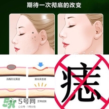 藥水點(diǎn)痣和激光點(diǎn)痣哪個(gè)好？各有什么優(yōu)缺點(diǎn)