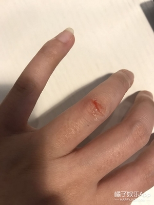 液體創可貼防水嗎？液體創可貼防水嗎透氣嗎？