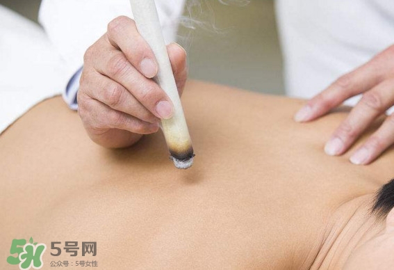 一天中什么時間艾灸好？艾灸什么時間做最好