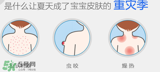 妙思樂爽膚水好用嗎？妙思樂爽膚水能去痱嗎？