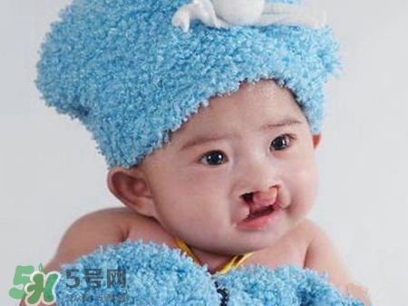 兔唇可以治嗎？兔唇修補術
