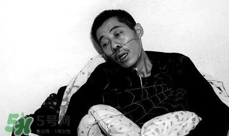 塵肺病吃什么藥能清肺？塵肺病國家有什么政策