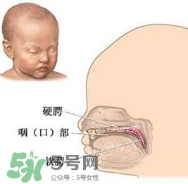 兔唇能檢查出來嗎？兔唇能完全修復嗎？