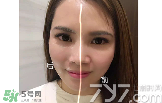 黃金棒有什么用？黃金棒的功效與作用