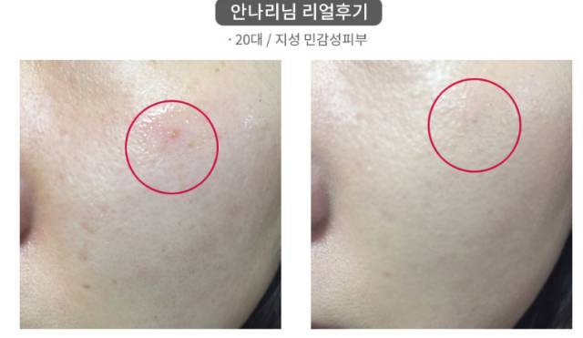 real skin patch怎么樣？real skin是什么牌子