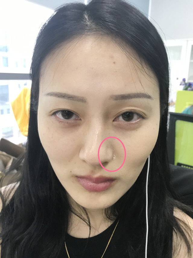 real skin patch怎么樣？real skin是什么牌子