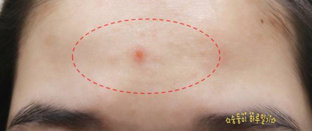 real skin patch怎么樣？real skin是什么牌子