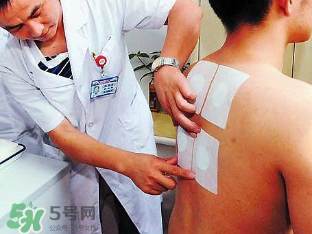 三伏灸可以治療什么病？三伏灸與艾灸有什么區別