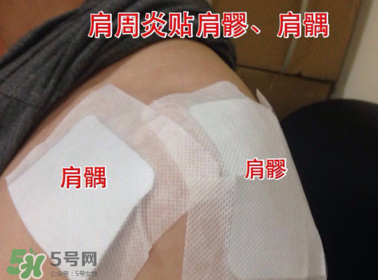 艾灸貼多少錢一盒?？艾灸貼一盒60裝多少錢？
