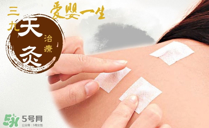貼三伏貼可以吃魚嗎？貼三伏貼可以吃什么魚？