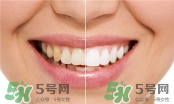 四環素牙能美白嗎?有四環素牙怎么辦?