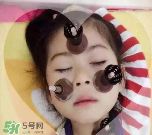 艾灸貼可以治咳嗽嗎？艾灸貼可以治退燒嗎？