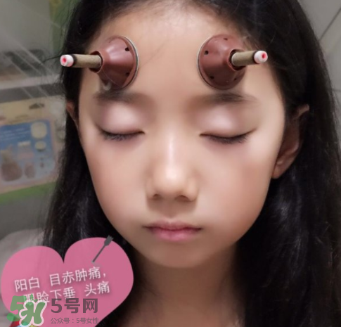 艾灸貼可以治咳嗽嗎？艾灸貼可以治退燒嗎？