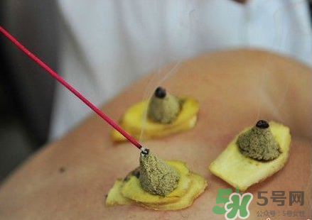 三伏灸可以自己灸嗎？三伏灸可以在家做嗎？