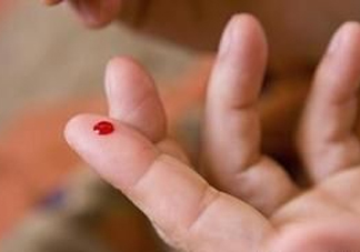放血療法能治濕氣重嗎？放血療法治病的原理是什么