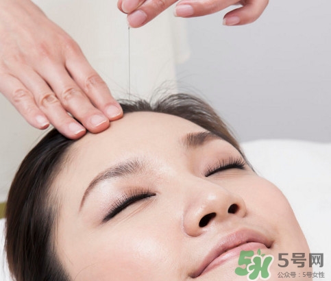 針灸到底疼不疼啊？針灸最適合哪些病