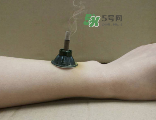 三伏天下雨可以艾灸嗎？三伏天下雨艾灸好嗎？