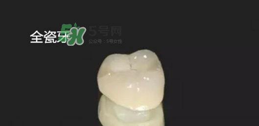 烤瓷牙和全瓷牙有什么區別?烤瓷牙和全瓷牙的區別